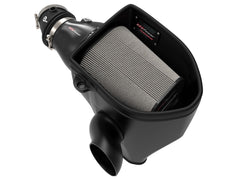AFE 57-10001D Track Series Stage-2 Carbon Fiber Intake System w/ Pro DRY S Media