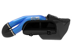 AFE 50-30024DL Momentum XP PRO DRY S Cold Air Intake System w/Blue Aluminum Intake Tubes
