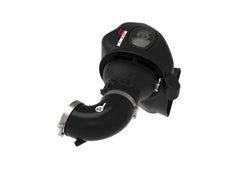 AFE 50-70049D Momentum GT Cold Air Intake System w/ Pro DRY S Media
