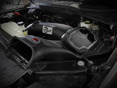 AFE 50-70074D Momentum GT Cold Air Intake System w/ Pro DRY S Media